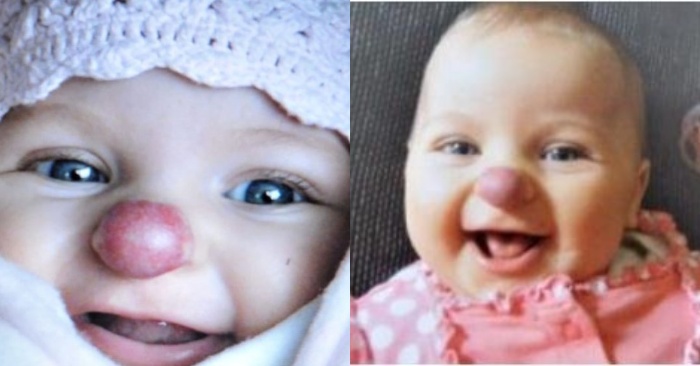  Quand cette fille est née, elle ressemblait à un petit pitre, avec une marque rouge sur son nez  maintenant elle est devenue comme ça
