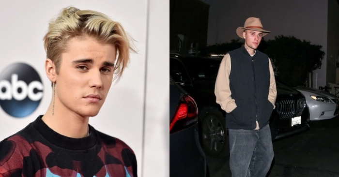 Le premier sourire du célèbre Justin Bieber après une rare paralysie faciale  voici de nouvelles photos de célébrités