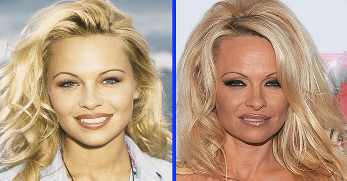  La beauté s’estompe  les fans ne reconnaissent pas Pamela Anderson, elle ressemble à une vieille dame