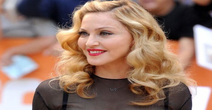  Cicatrices énormes et aucun préjugé  62 ans Madonna a montré ses jambes après l’opération
