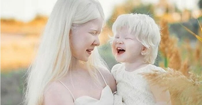  Quelle vie unique est : c’est ainsi que vit une famille dans laquelle sont nées des sœurs albinos
