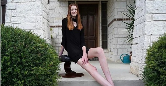  Jambes trop longues : cette fille unique a les jambes les plus longues dans le monde entier