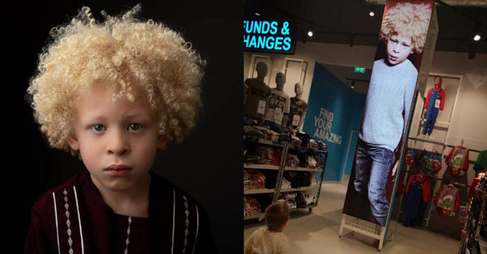  Être inhabituel est également génial 5 ans albinos garçon est devenu un modèle après avoir vu sa photo