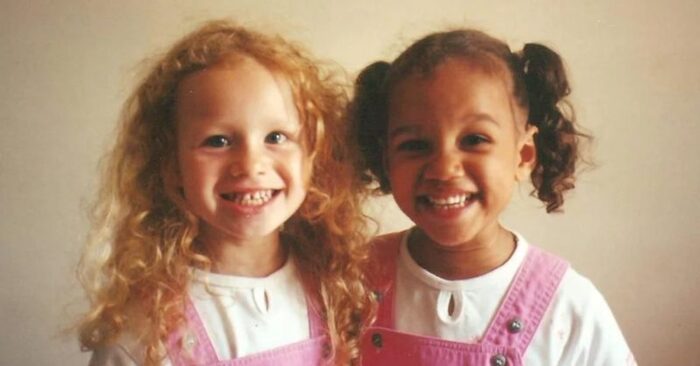  Une histoire intéressante: les jumeaux sont nés avec différentes couleurs de peau et c’est ce à quoi ils ressemblent 20 ans plus tard