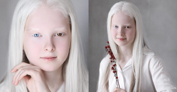  La fille aux yeux colorés différents: voici l’un des albinos les plus beaux et uniques au monde