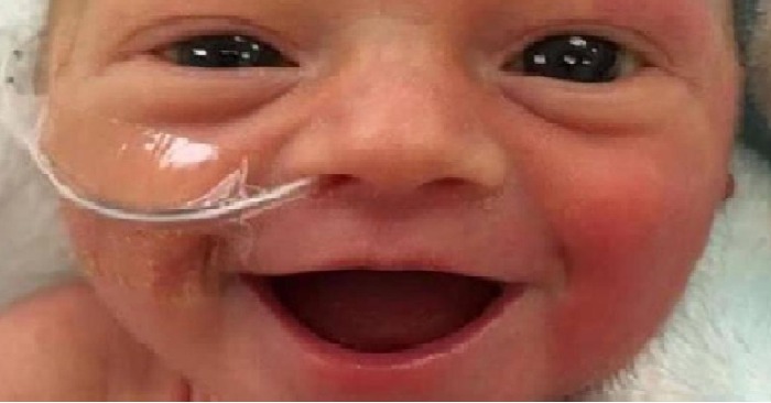  Le sourire d’un bébé prématuré est devenu une lueur d’espoir pour de nombreux parents