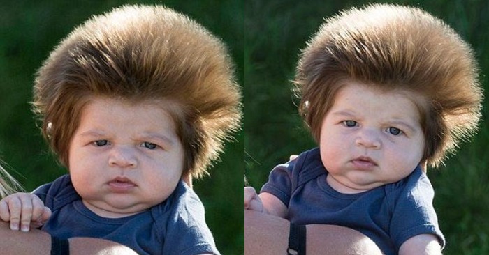  Une apparence incroyable: voici à quoi ressemble maintenant le garçon qui est né avec des cheveux incroyables