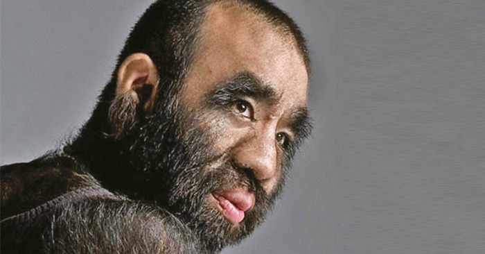  «King Kong dans la vraie vie»: Voici l’homme le plus poilu du monde qui est apparu dans le Livre Guinness des records