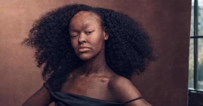  «Femme née avec une peau de serpent»: l’histoire intéressante du mannequin le plus unique au monde